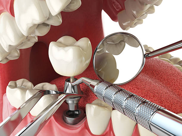 Best Dentist for Dental Trauma  in Godfrey, IL